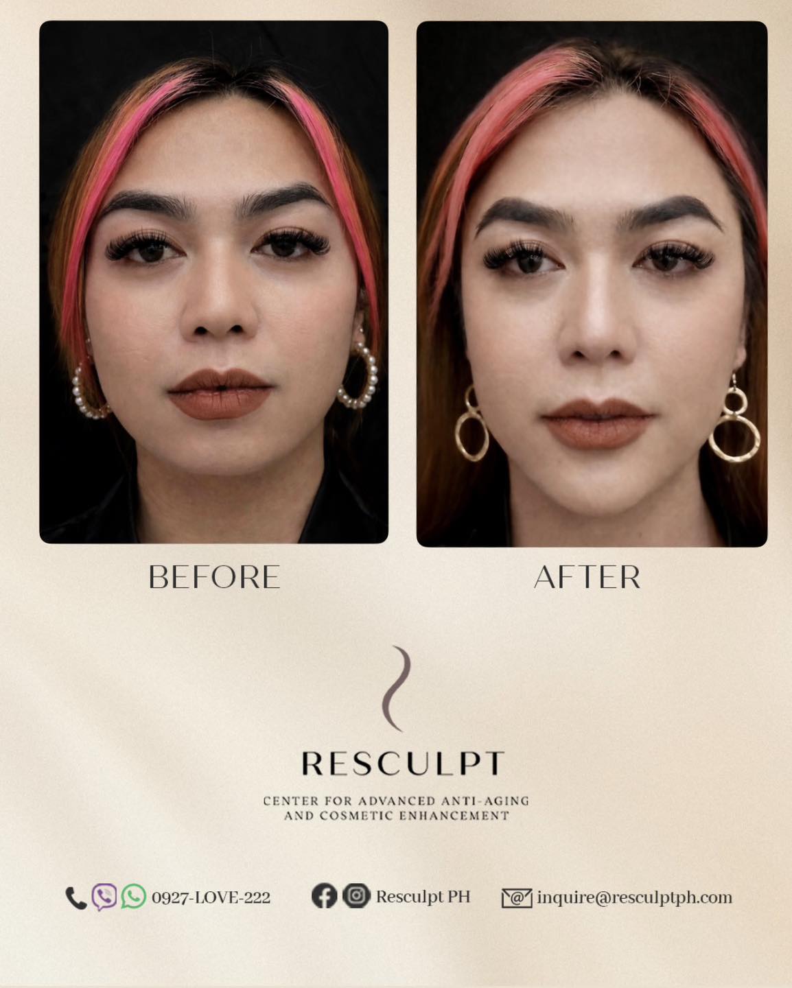 Resculpt PH Facebook ad: Get the facial balance you deserve!
