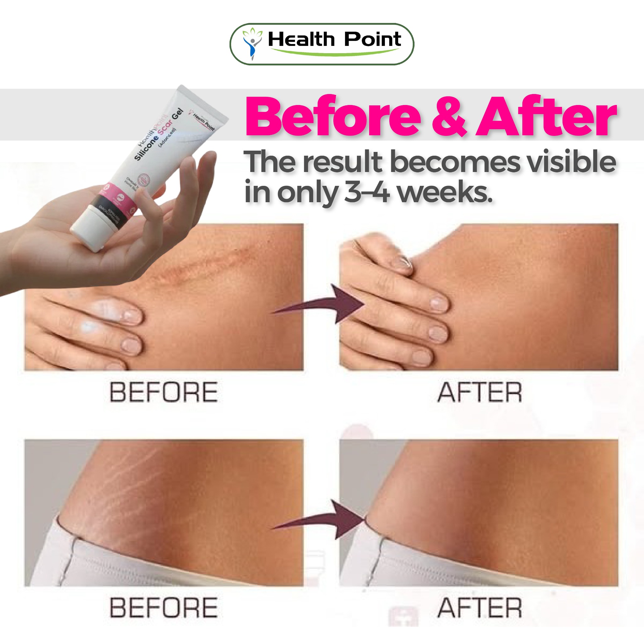 Health Point Pakistan Facebook ad: Scar Gel - Real Results in 2 Weeks!