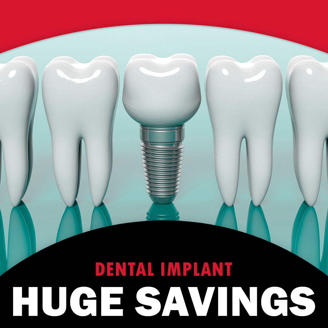 Daryl Robertson, DDS Facebook ad: Dental Implant Special Offer