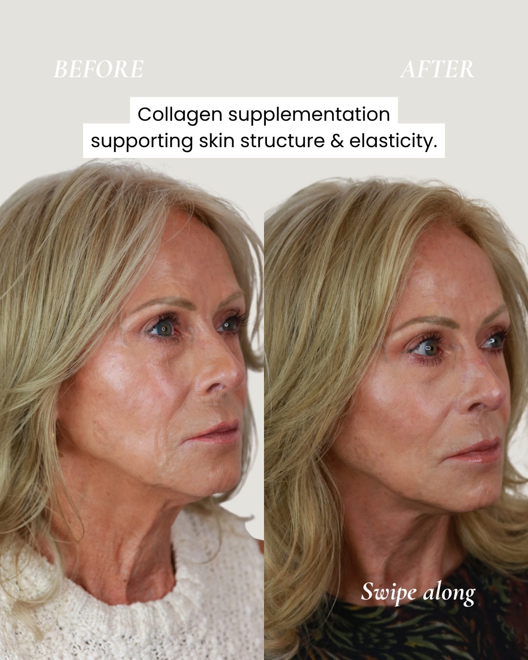 Clinicbe Facebook ad: In this treatment journey, we focused on key…