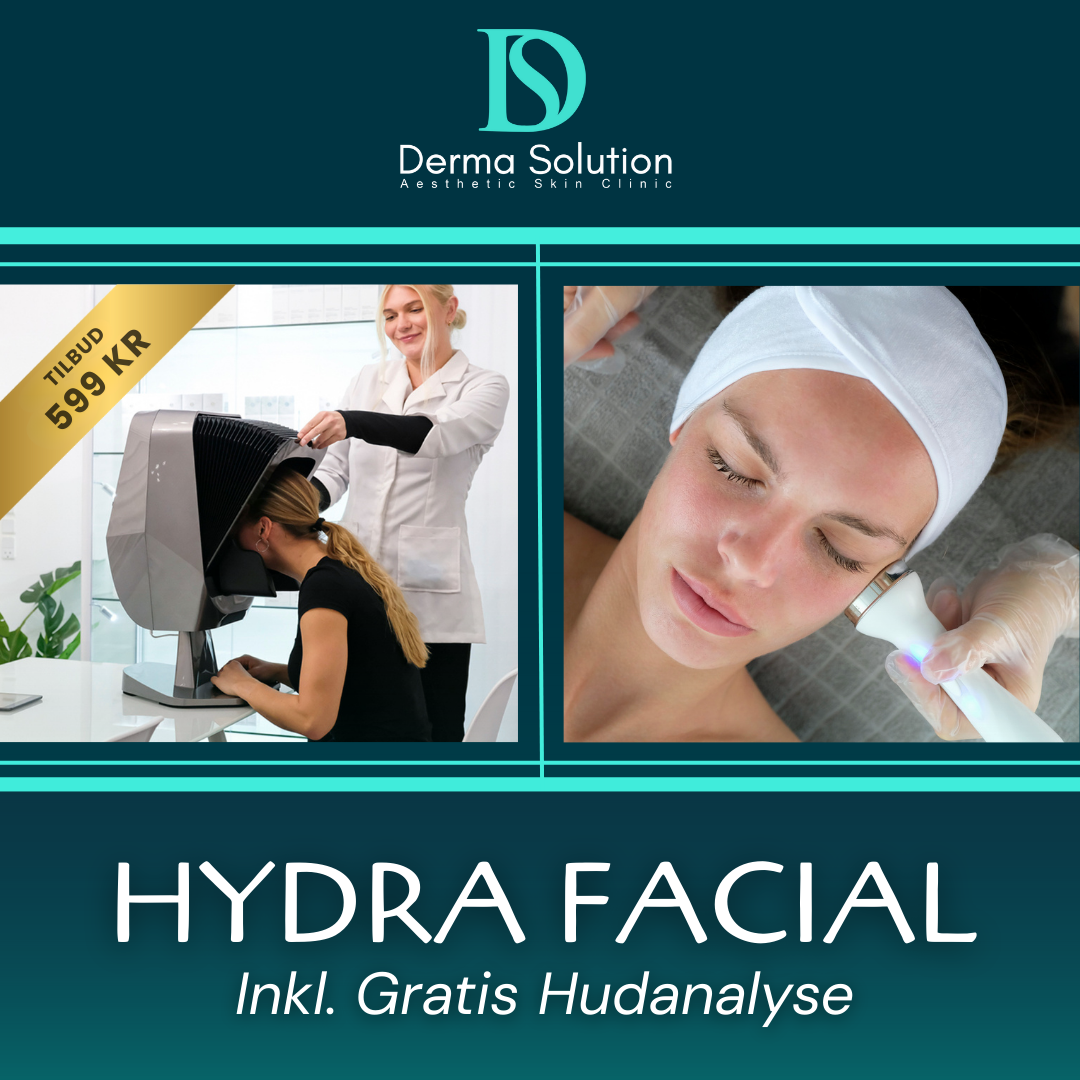 Derma Solution Copenhagen Facebook ad: Hydra Facial til 599 kr (Normalt 1800 kr)