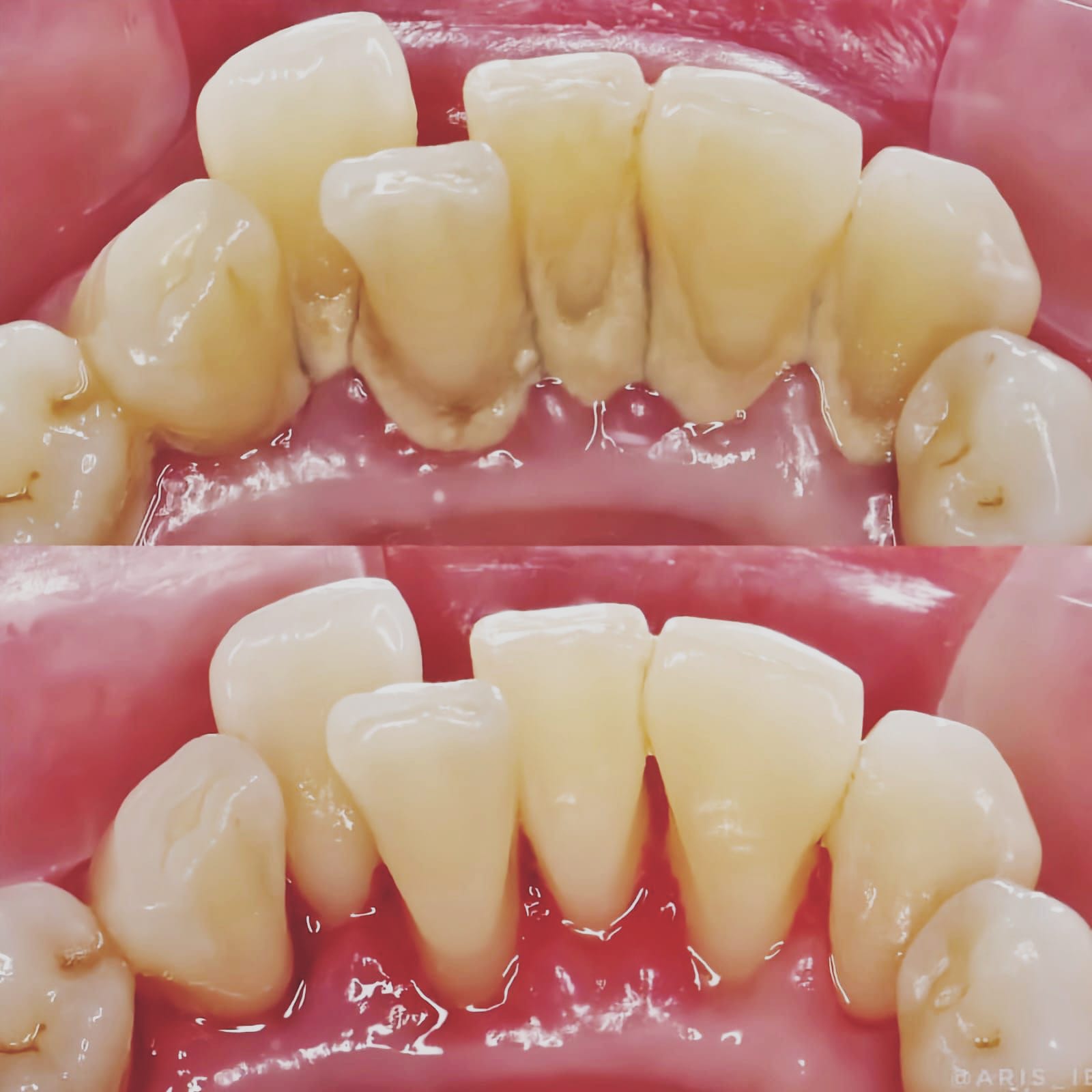Dento Smile Care Facebook ad from Jun 12, 2026