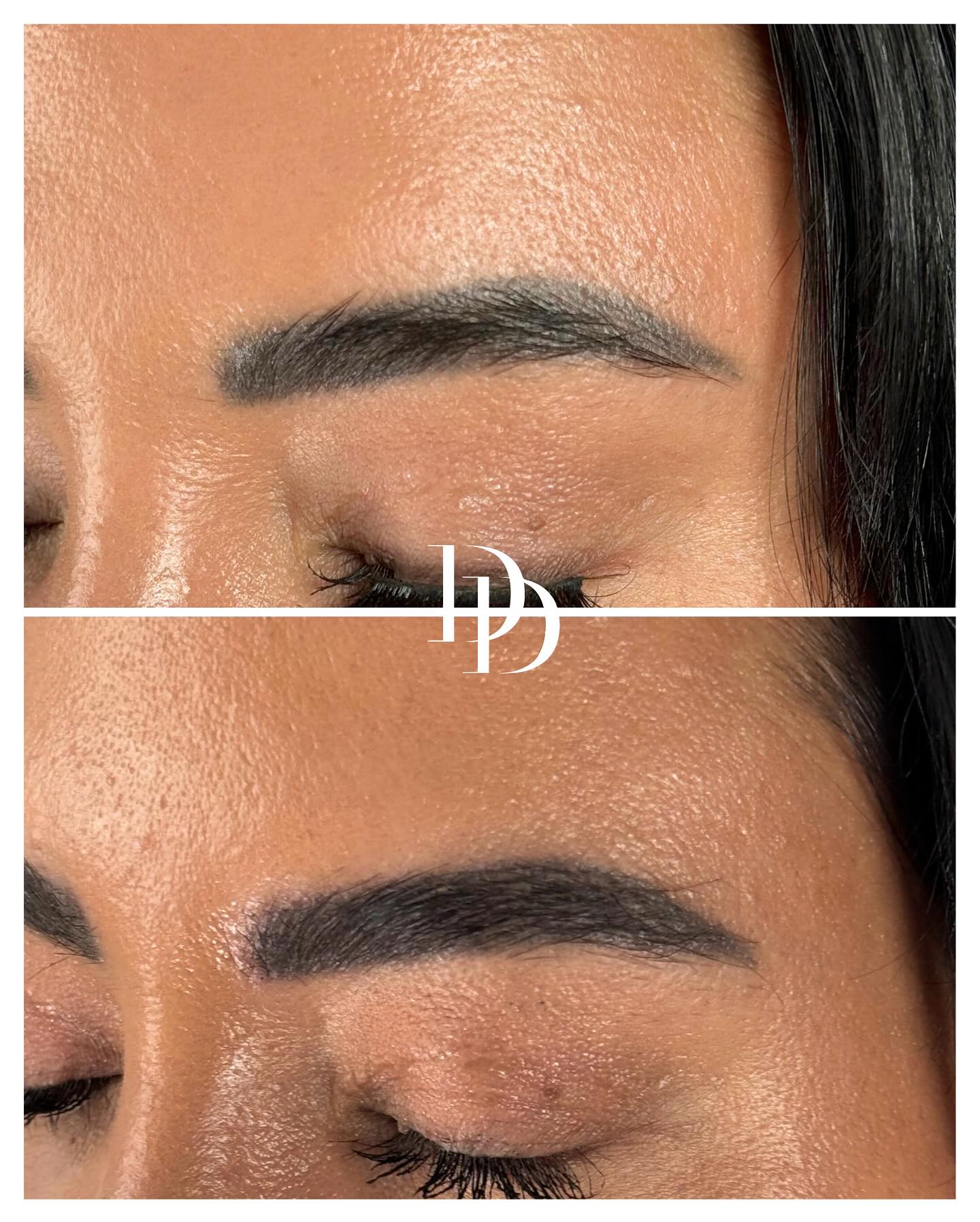 Dr Ducu Clinics Facebook ad: Eyebrow Transplant, Ask About Our August Offer.
