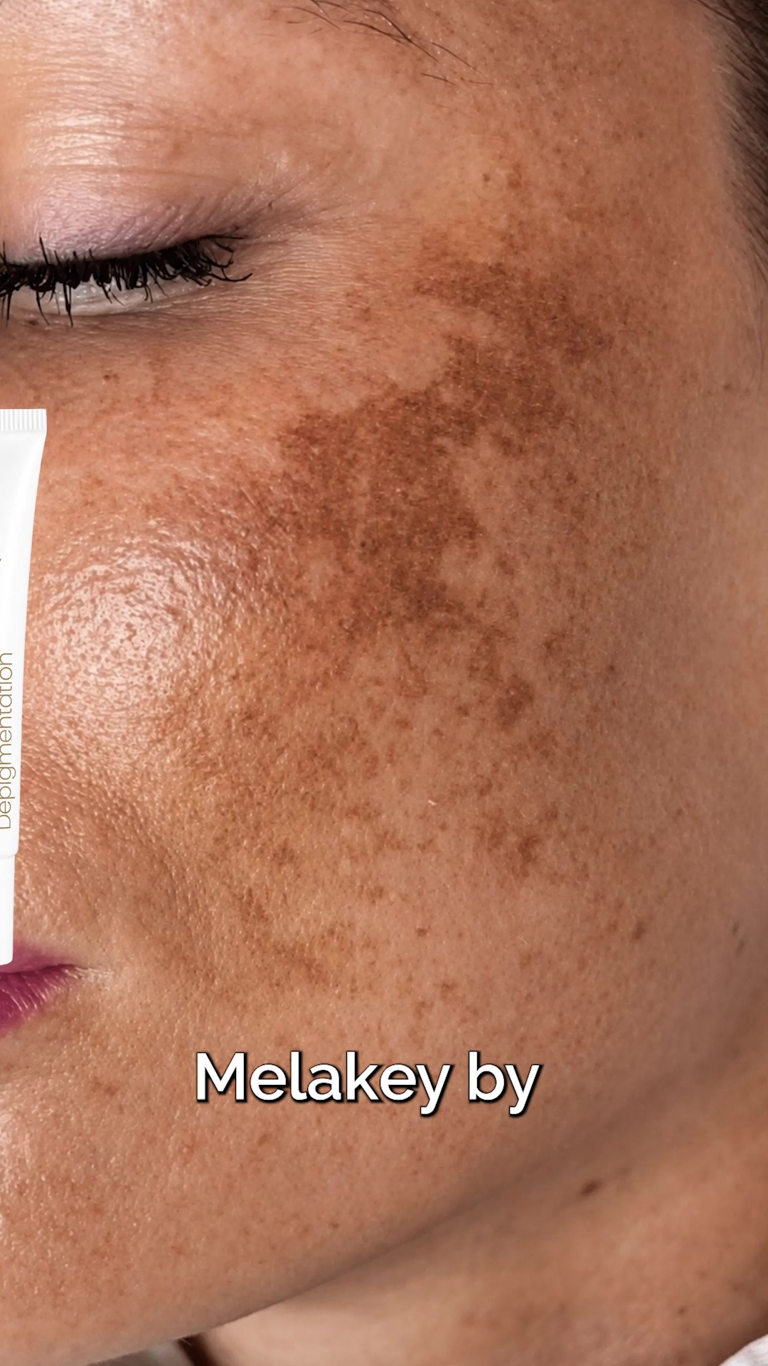 Skin Care Personal Touch Facebook ad: Melasma? Dark Spots? This Works.