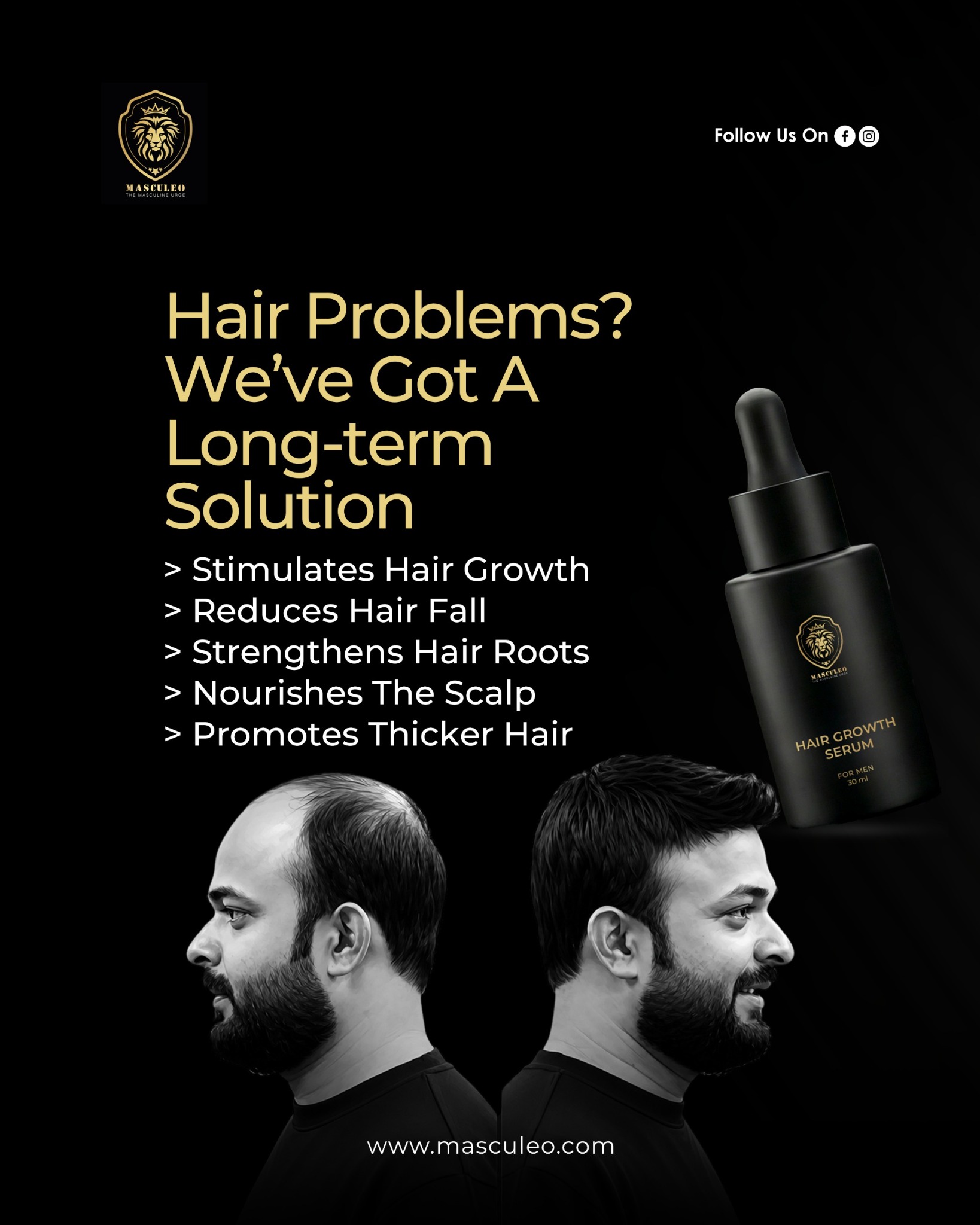 Masculeo Facebook ad: Hair problems holding you back? It’s time to take control.