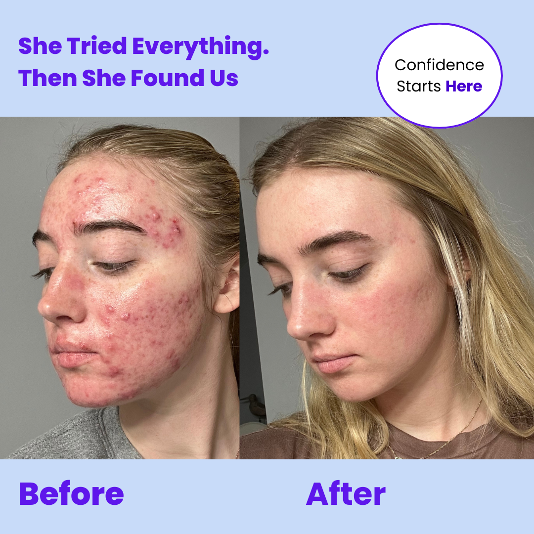 Be Blessed Skin Care Facebook ad: Shop Now