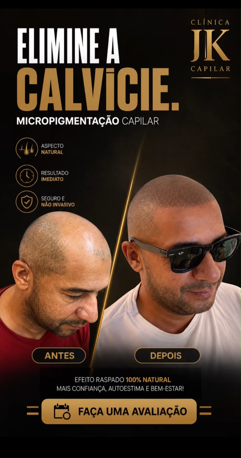 Kadu Capilar Facebook ad: EFEITO RASPADO