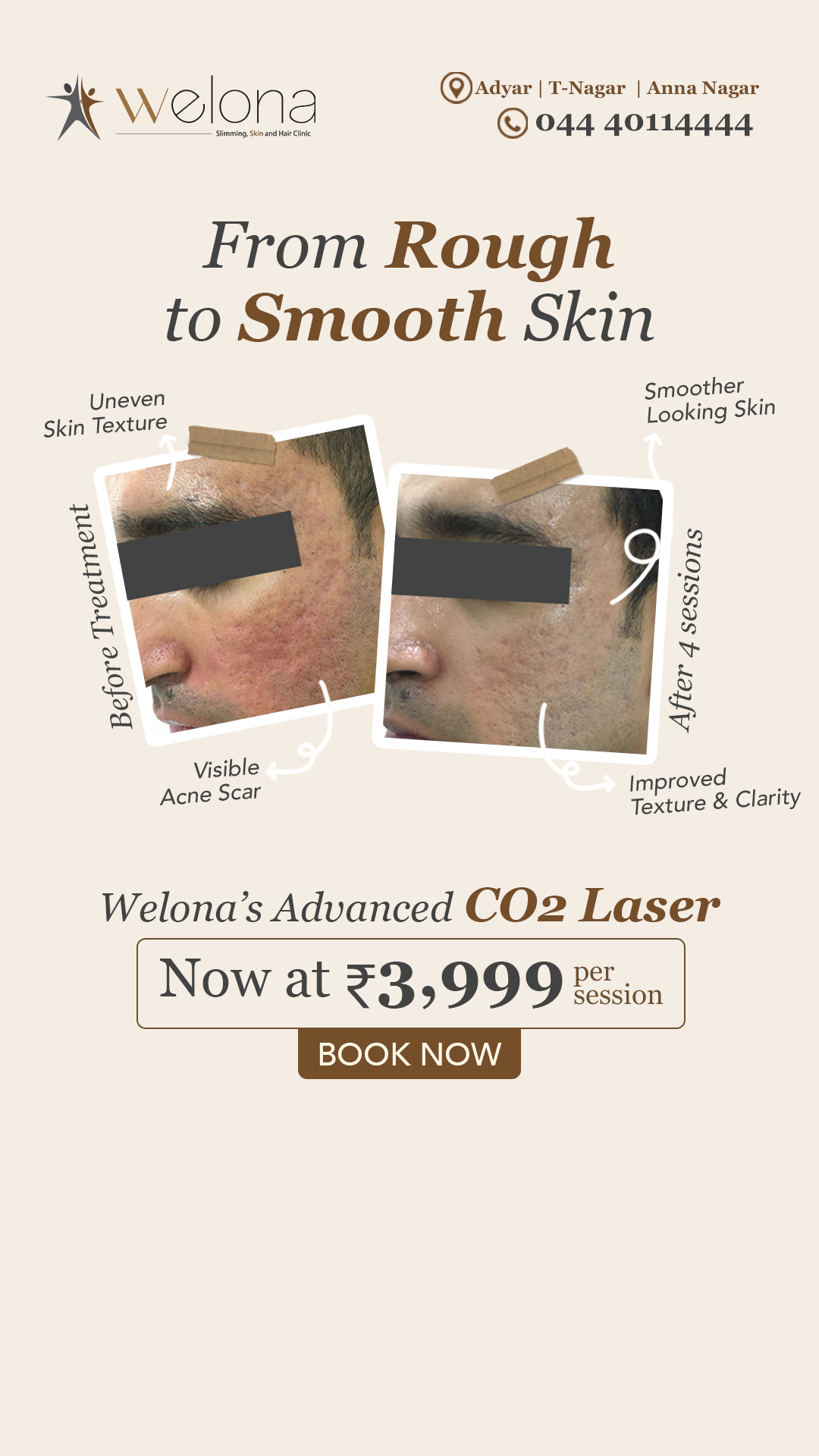 Welonaaesthetics Facebook ad