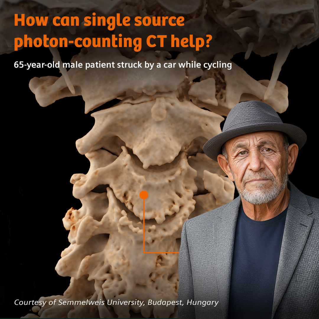 Siemens Healthineers Facebook ad: See how single source photon-counting CT is improving…