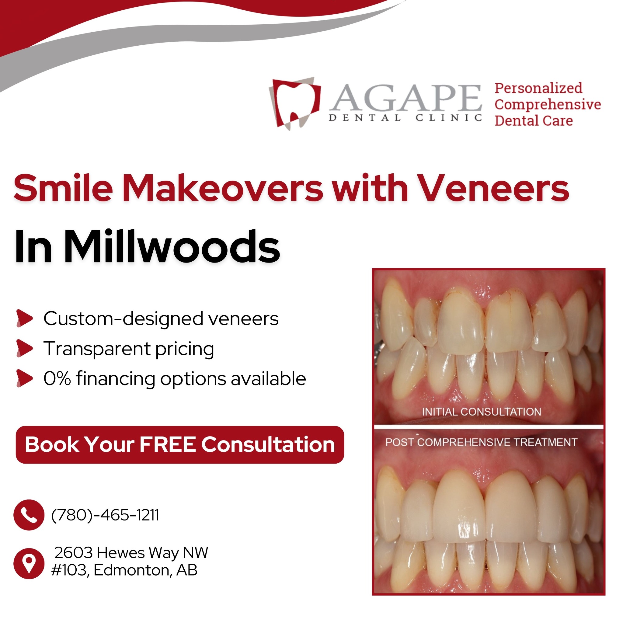 Agape Dental Clinic Millwoods Facebook ad