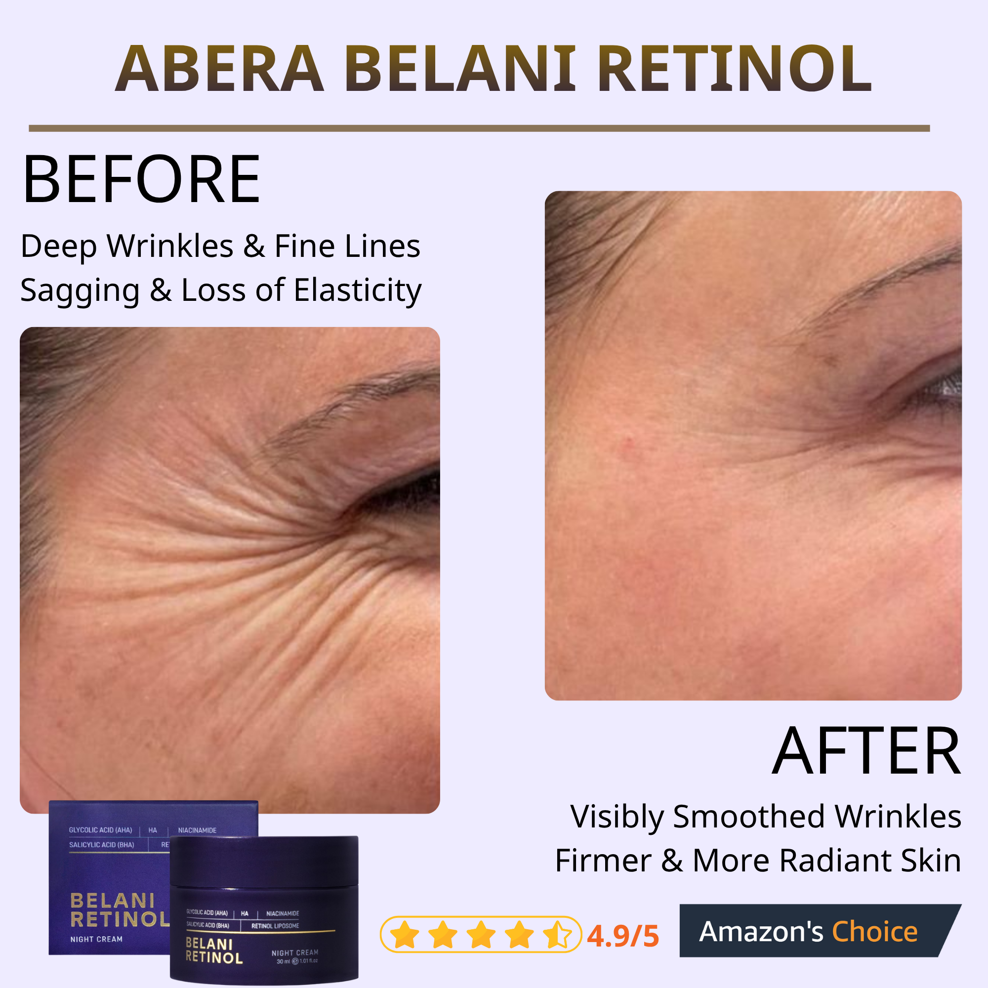 Belani Retinol Cream Facebook ad: Shop now on Amazon! Free Shipping & 30-Days Risk-Free