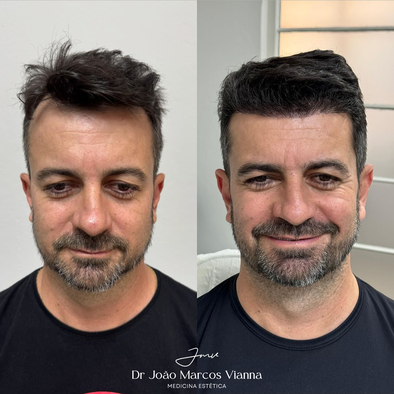 Dr. João Marcos Vianna Facebook ad: Do espelho à autoestima: o antes e depois…