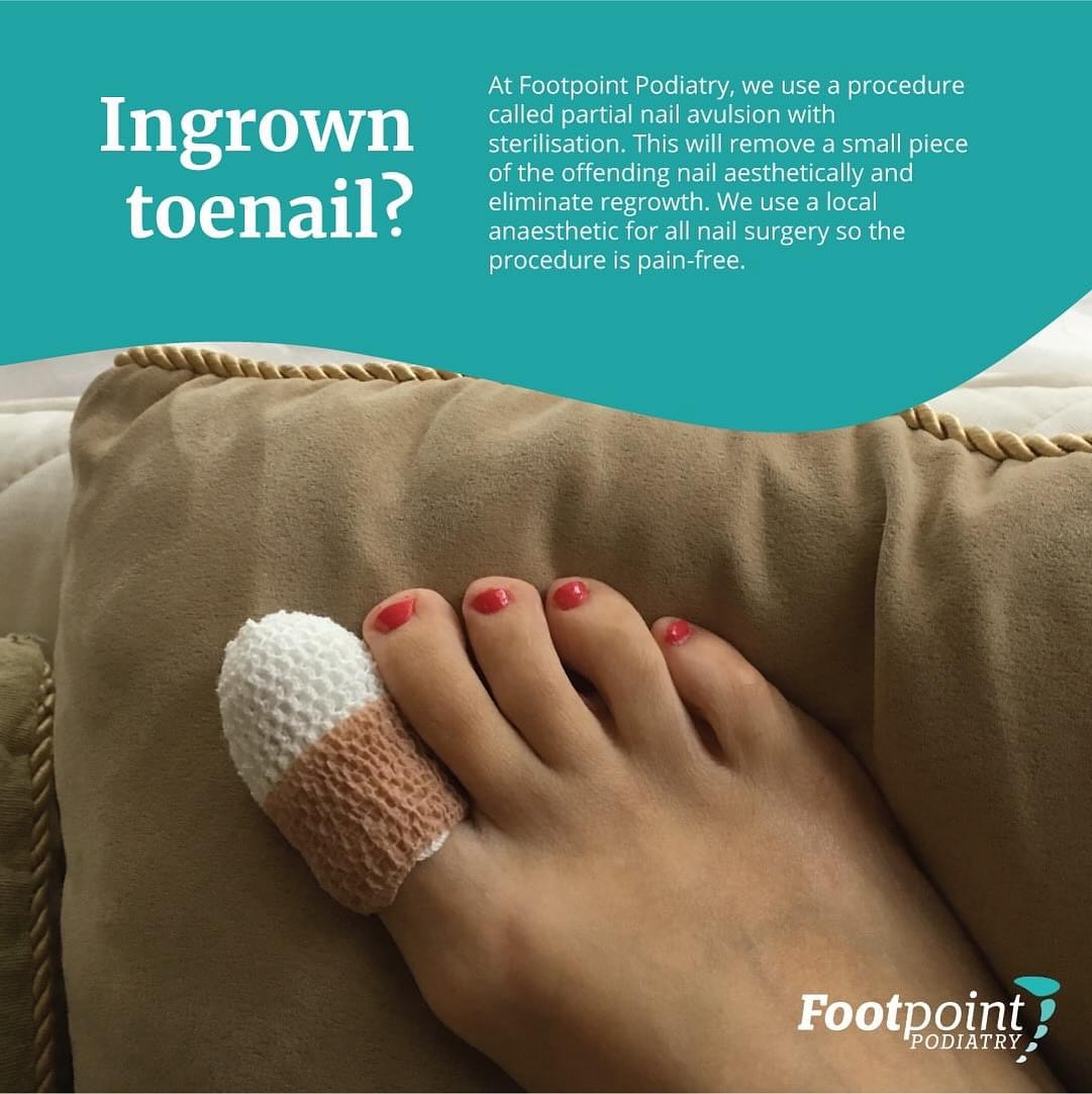 Footpoint Podiatry Facebook ad