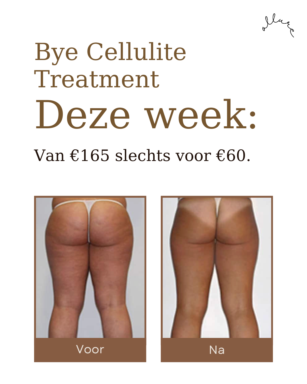 Allure Skin & Body Facebook ad: Alleen deze week
