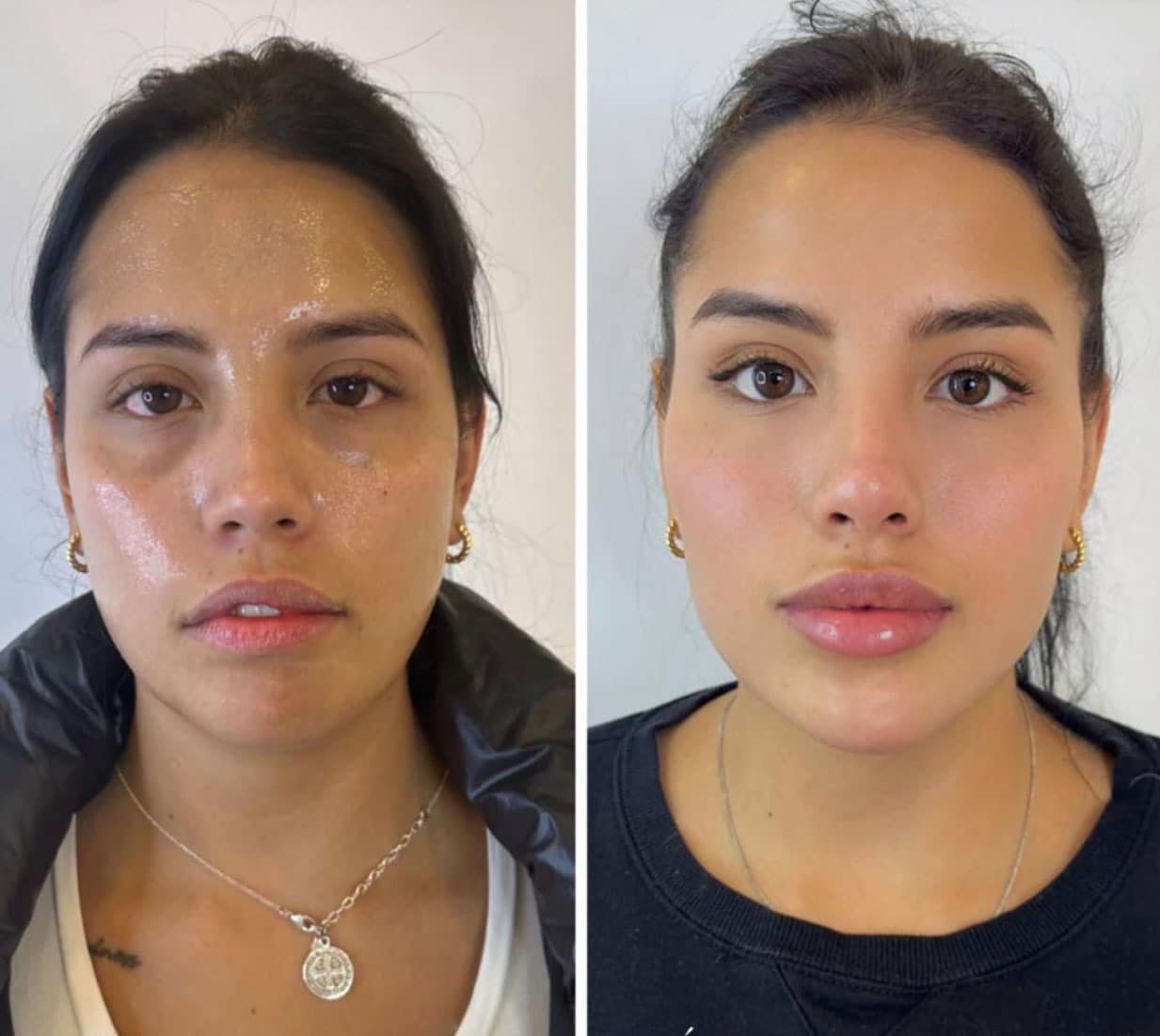 Clinica spa arte cuerpo  Facebook ad