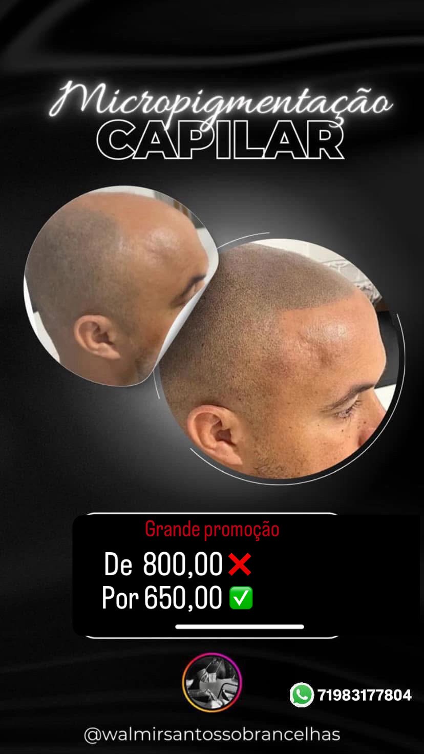 W.R.C micropigmentação Facebook ad from May 18, 2026