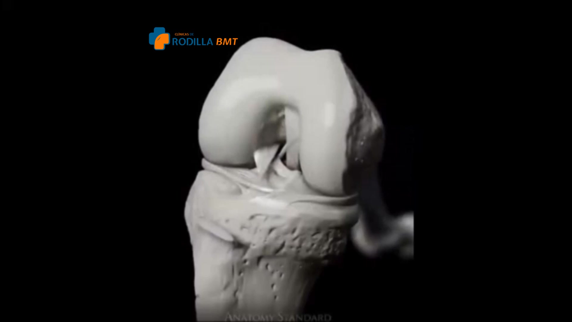Clínicas de Rodilla BMT Chihuahua y Cd Juárez Facebook ad: ¿Sabías que el cartílago sí puede repararse?