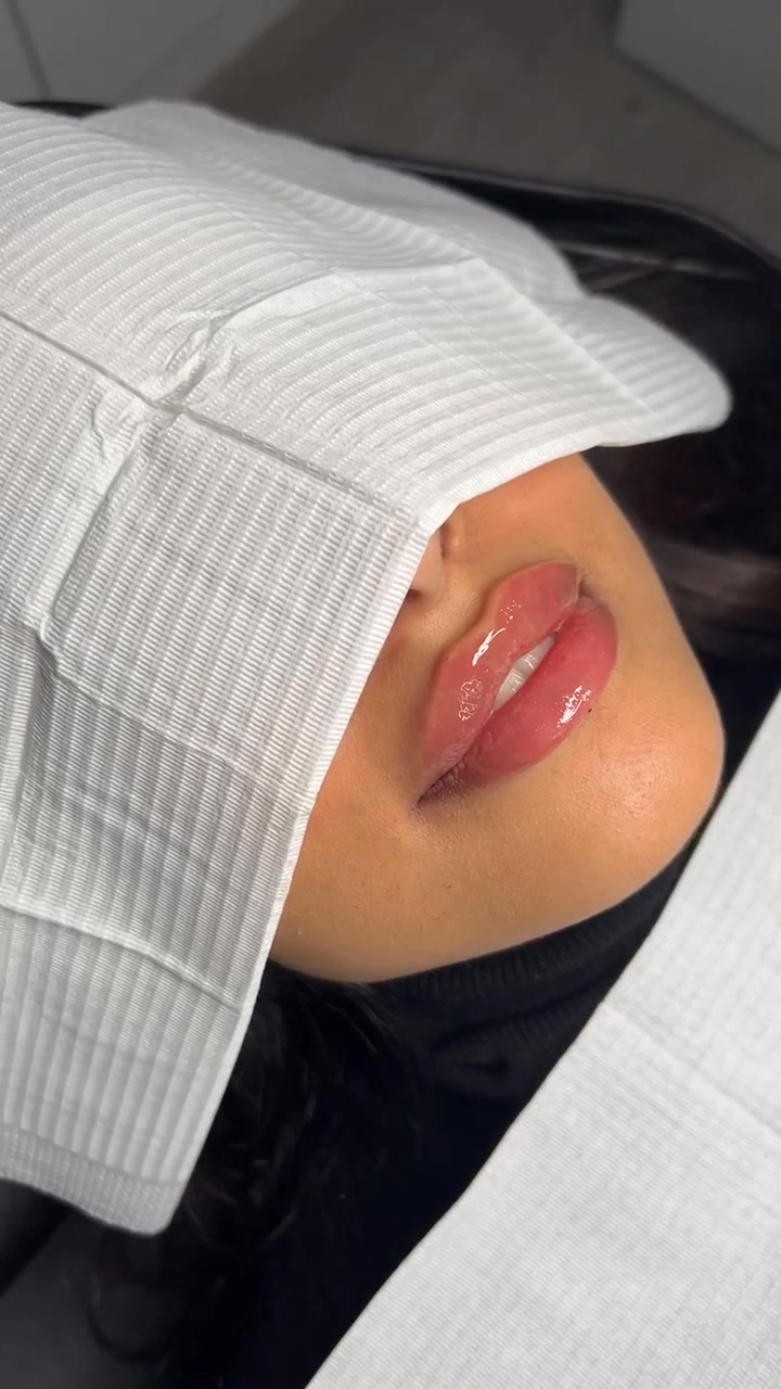 The Aesthetic Lab Facebook ad: $200 OFF Lip Filler