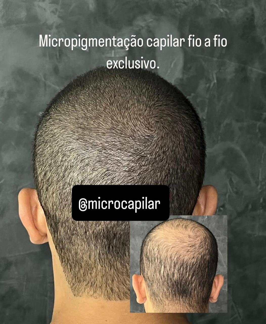 Nadiane Costa Mentora e Especilista em Micropigmentação Facebook ad