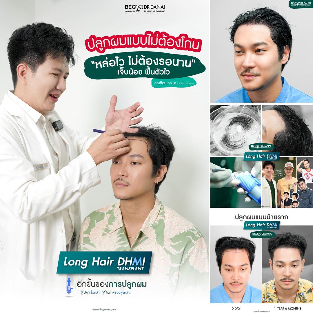 Dr. Danai Bangkok Hair Transplant ปลูกผมถาวร Facebook ad