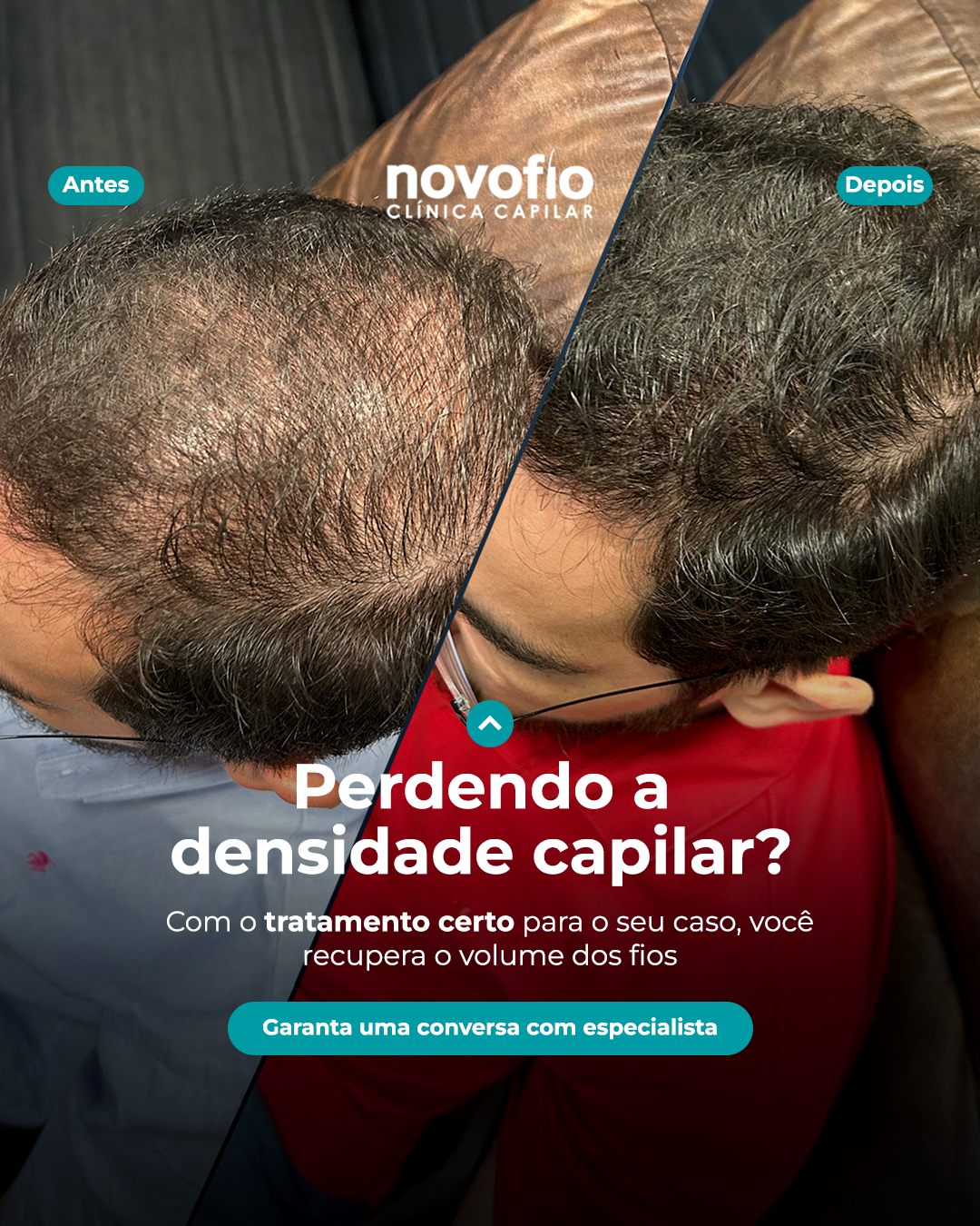 Novofio Osasco Clínica Capilar Facebook ad