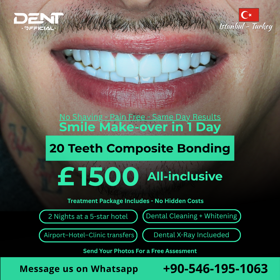 Dentofficial Global Facebook ad: Composite Bonding in Istanbul, Done in 1 Day