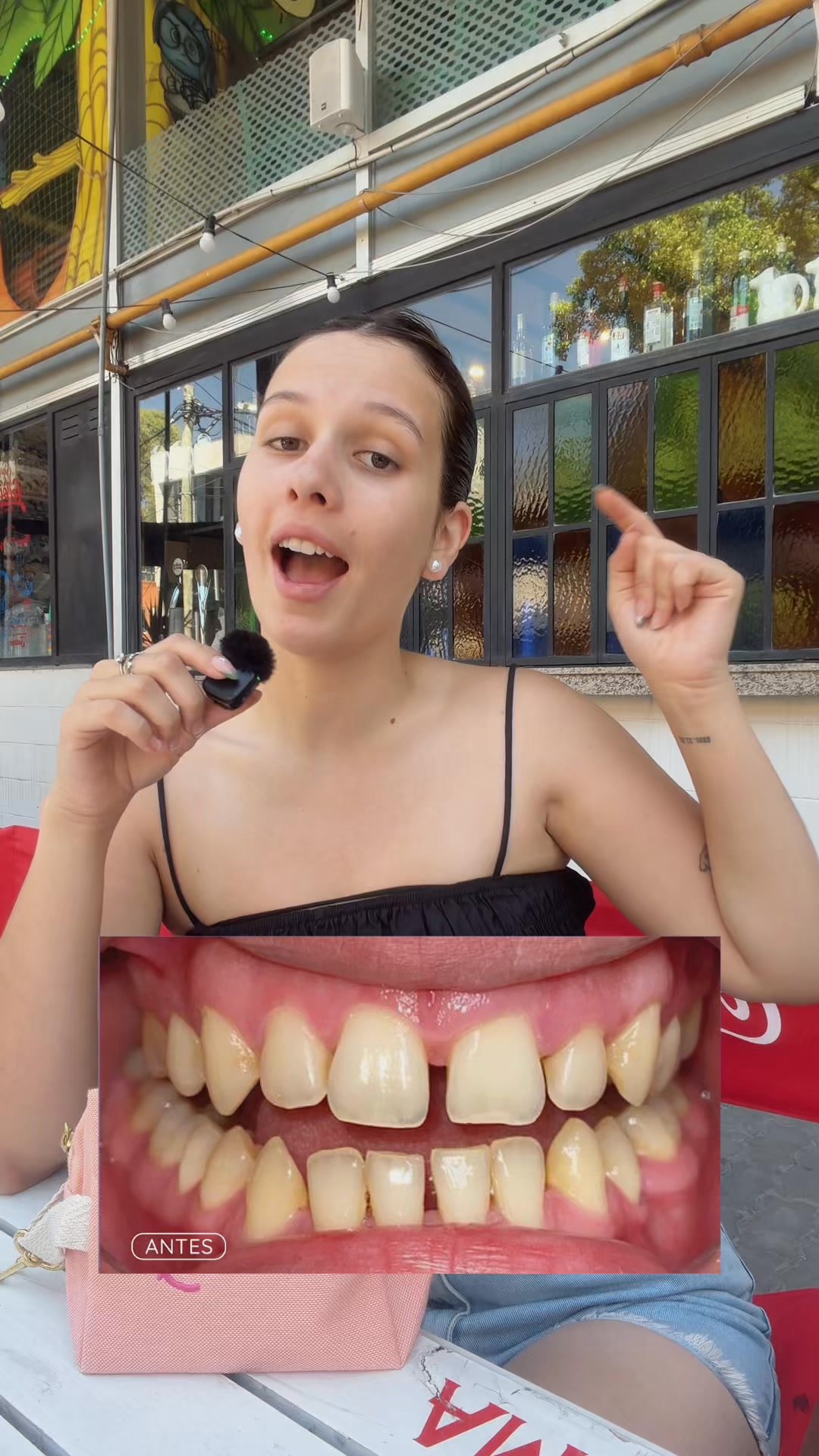 Glowup Argentina Facebook ad: Alineadores Dentales Invisibles