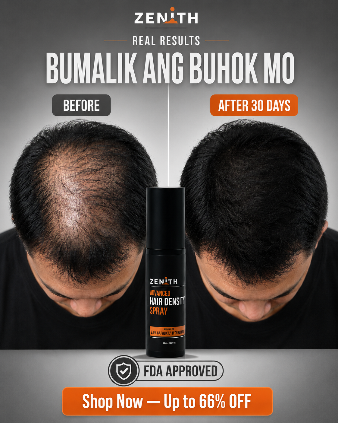 Zenith PH - High Performance Skincare For Men Facebook ad: Visit the Website to Start Your Hair Comeback