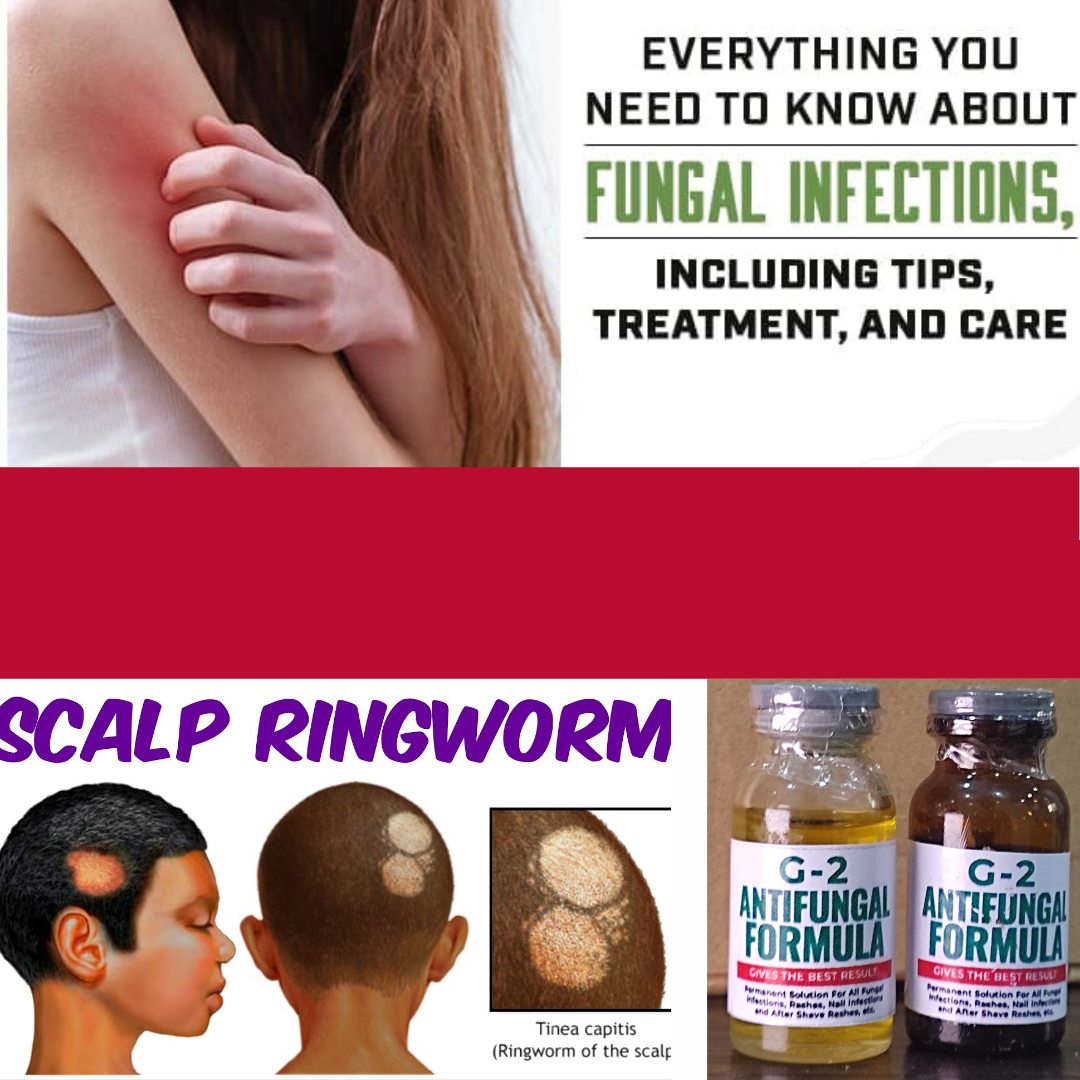 Fungal Natural Remedy Facebook ad