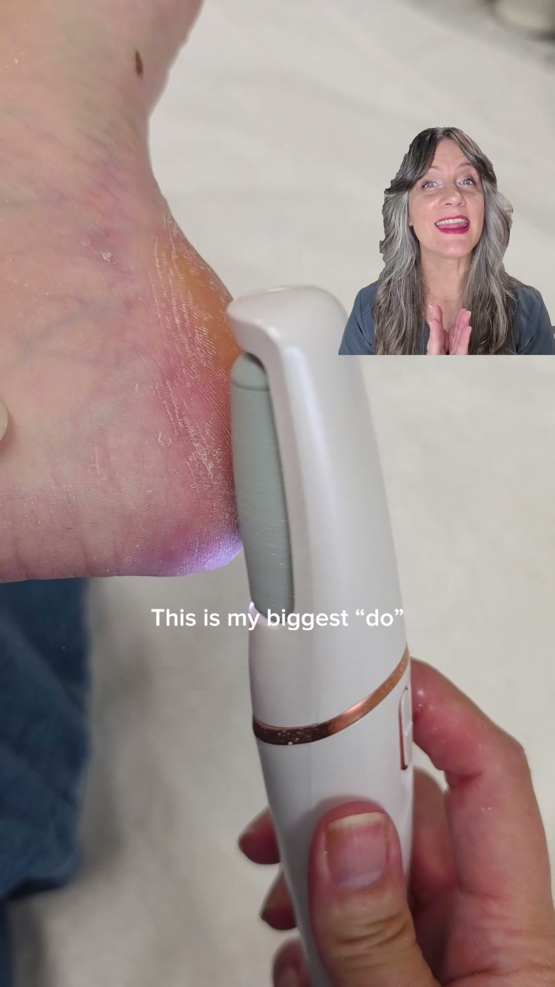 Nuvé Facebook ad: Baby soft feet in 5 minutes flat