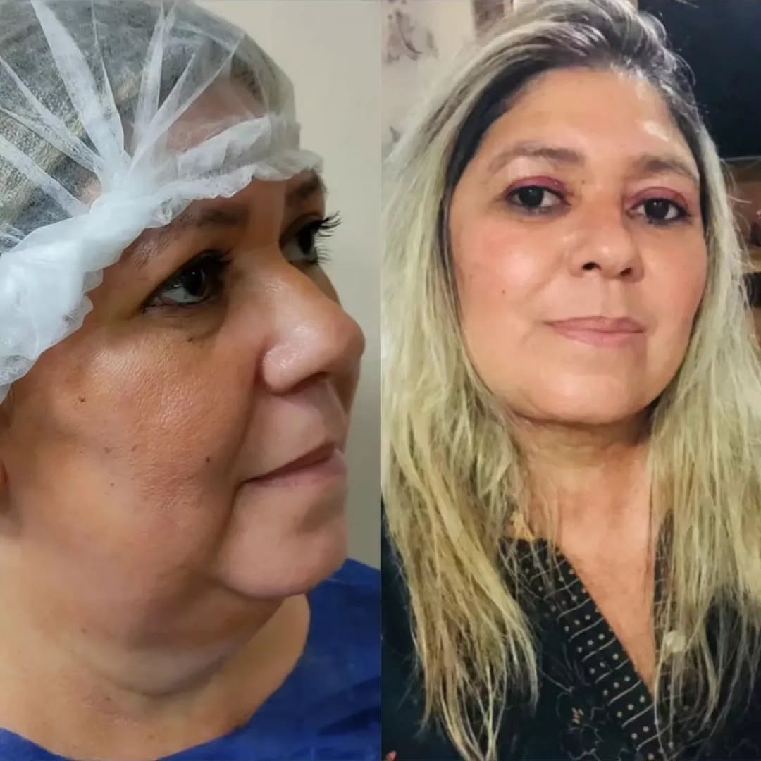 full.faces Facebook ad: Já pensou em literalmente mudar de vida?