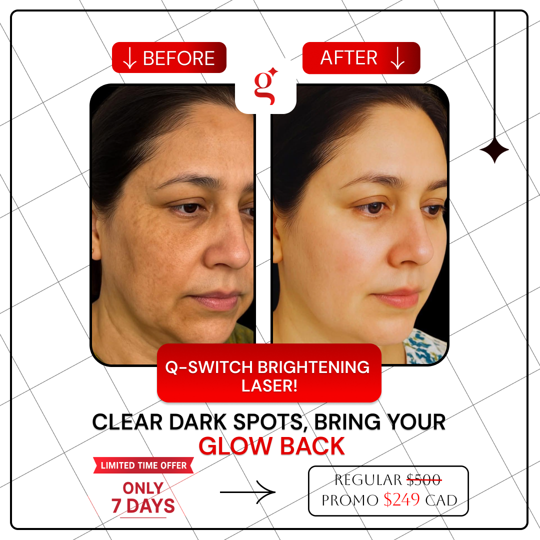 Glow & Go Facebook ad