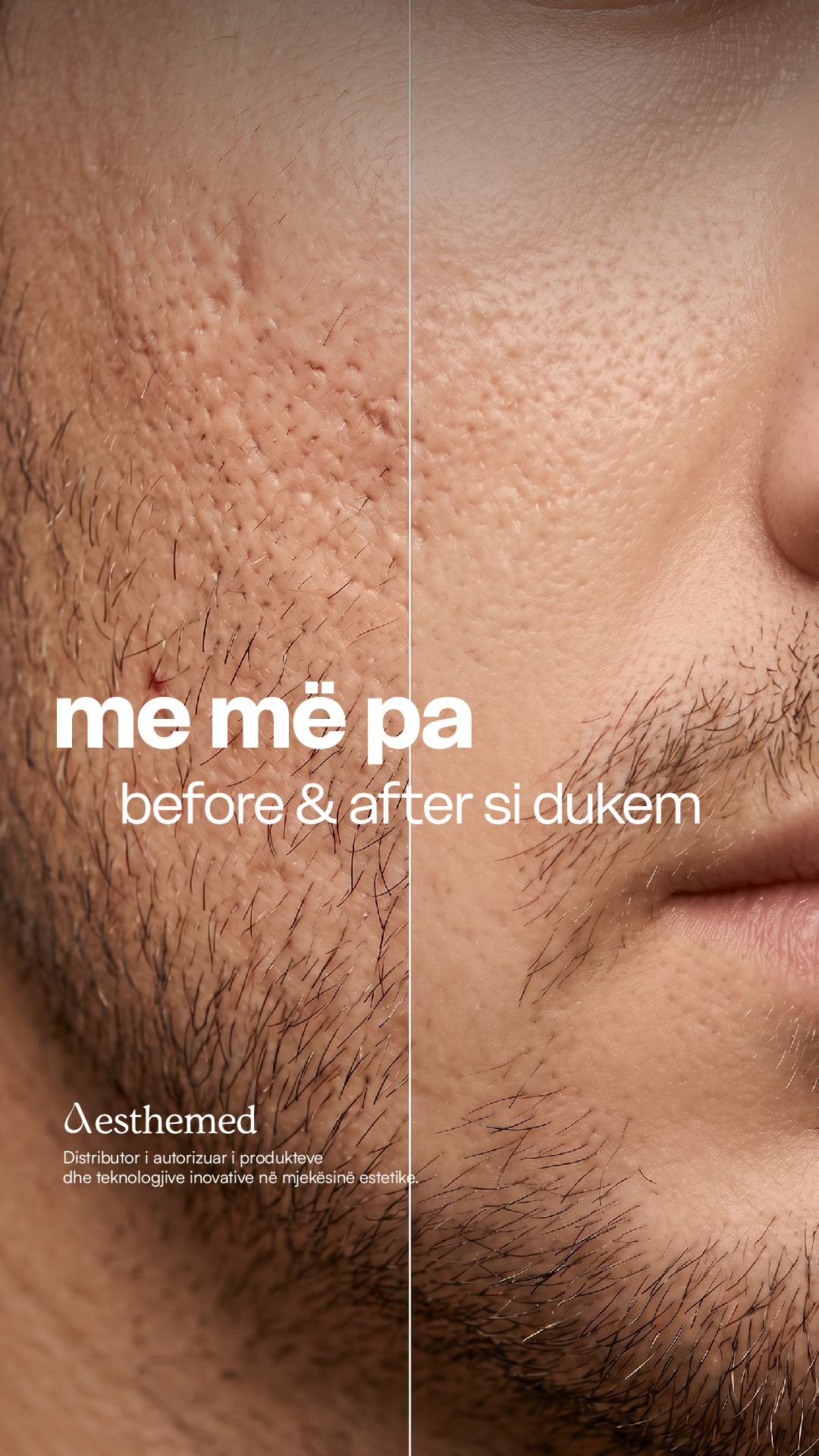 Aesthemed Balkans Facebook ad: Rezultatet flasin vetë: teksturë më e njëtrajtshme, më…