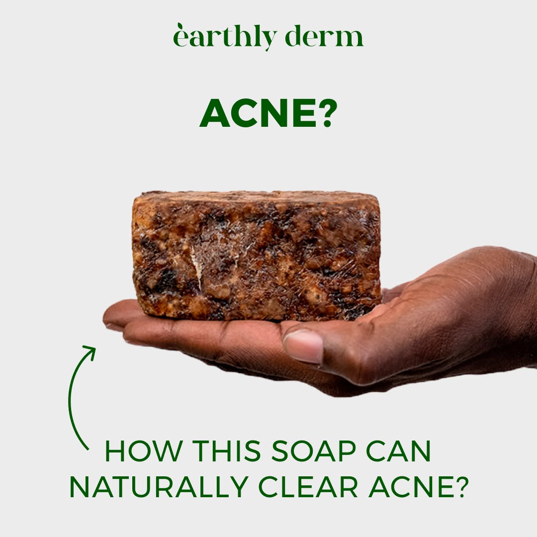 Earthly Derm Facebook ad