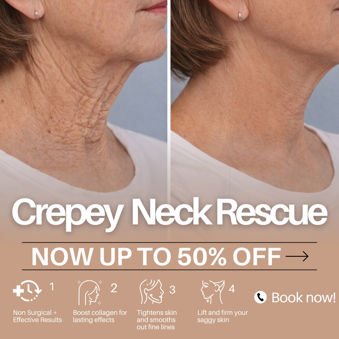 TM Aesthetics Facebook ad: London Skin Rejuvenation, Up To 50% Off CO2 Laser at TM…