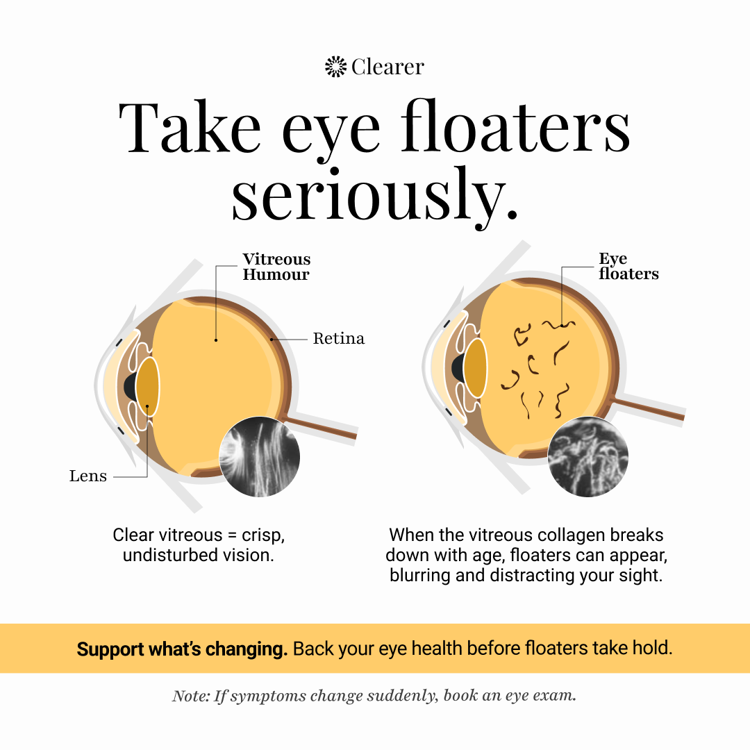 Clearer Eyecare Facebook ad