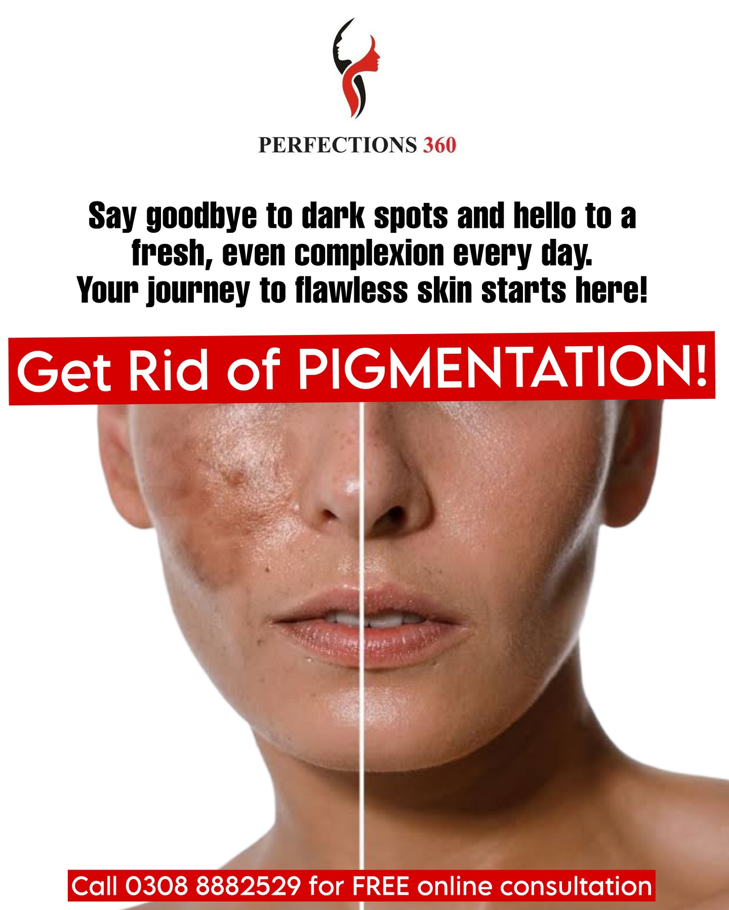 Perfections 360 Facebook ad: Say goodbye to pigmentation, dark spots & uneven…