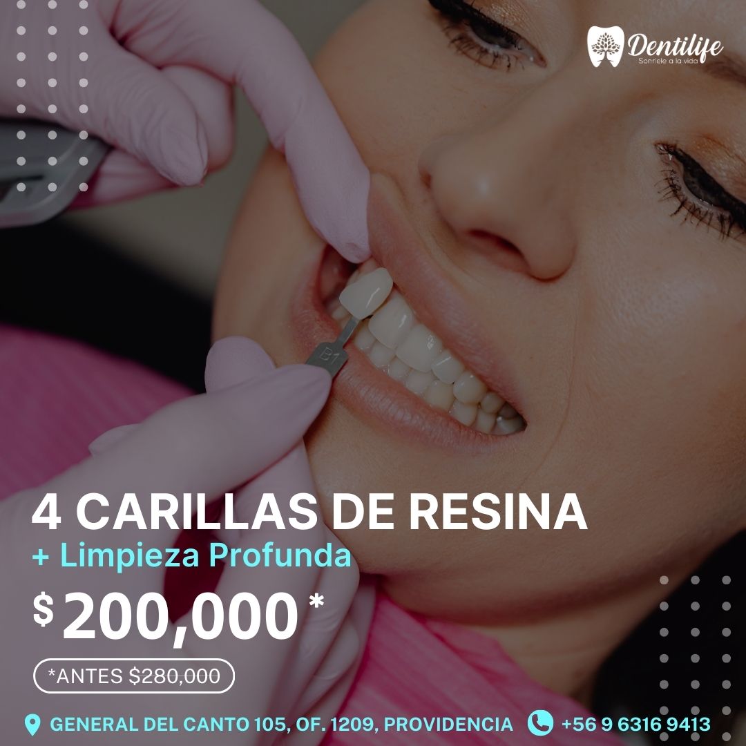 Dentilife Facebook ad