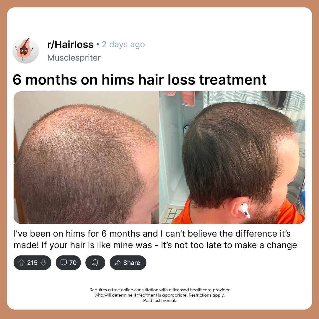 hims Facebook ad