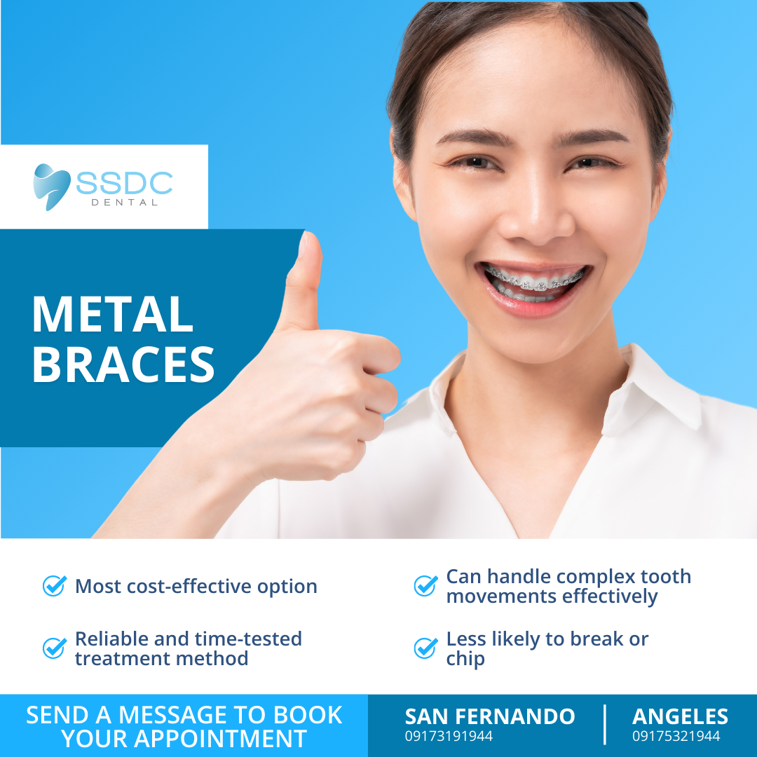 SSDC Dental Facebook ad