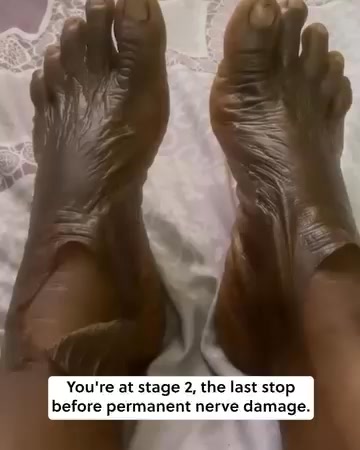 Jakasan Cosmetic Medicine Facebook ad: Support foot health daily