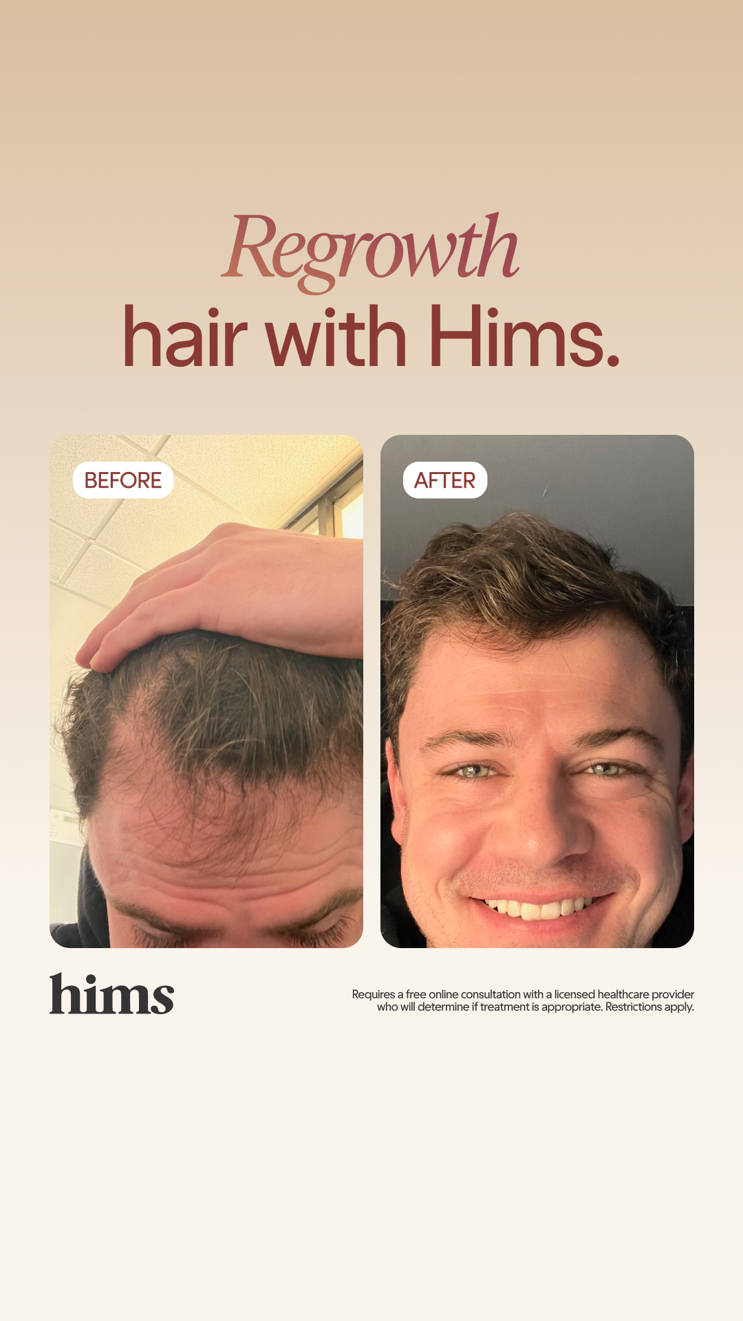 hims Facebook ad