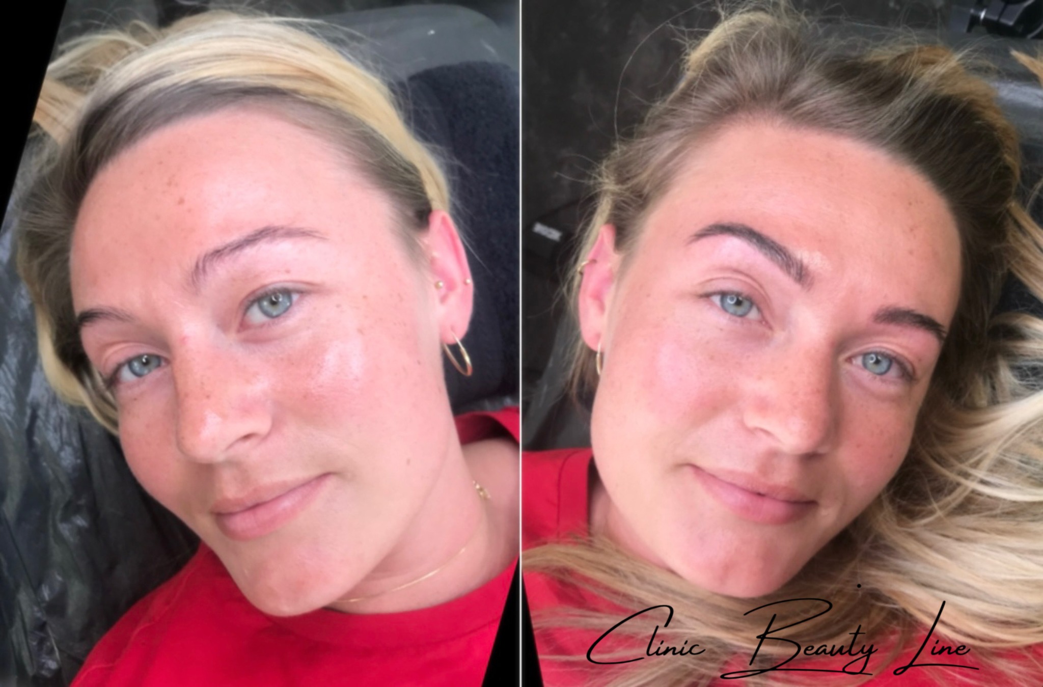 Clinic Beauty Line Facebook ad: Tranbjerg | Gratis og uforpligtende konsultation