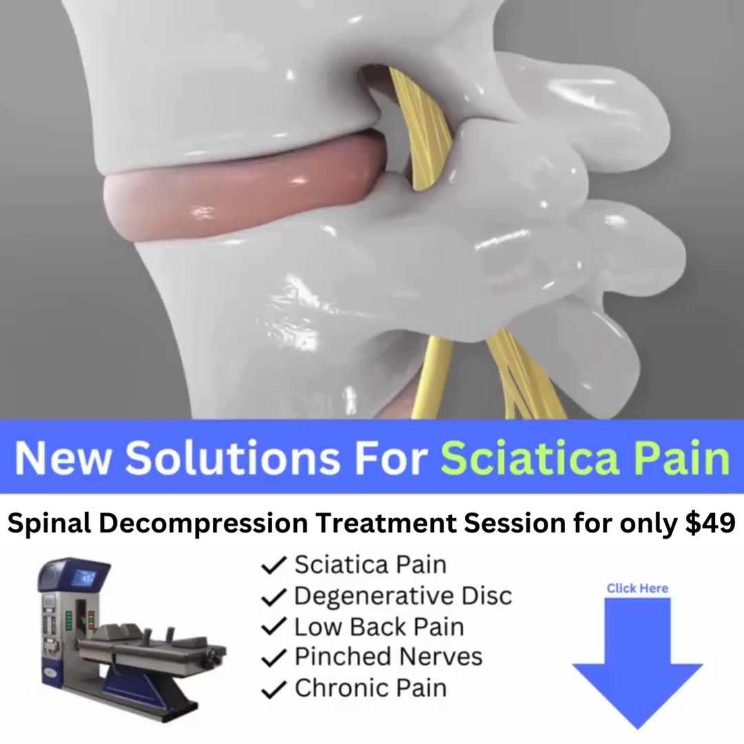 Physiomed -Vancouver Facebook ad: $49 Real Spinal Decompression Treatment, Exam + X-Rays +…