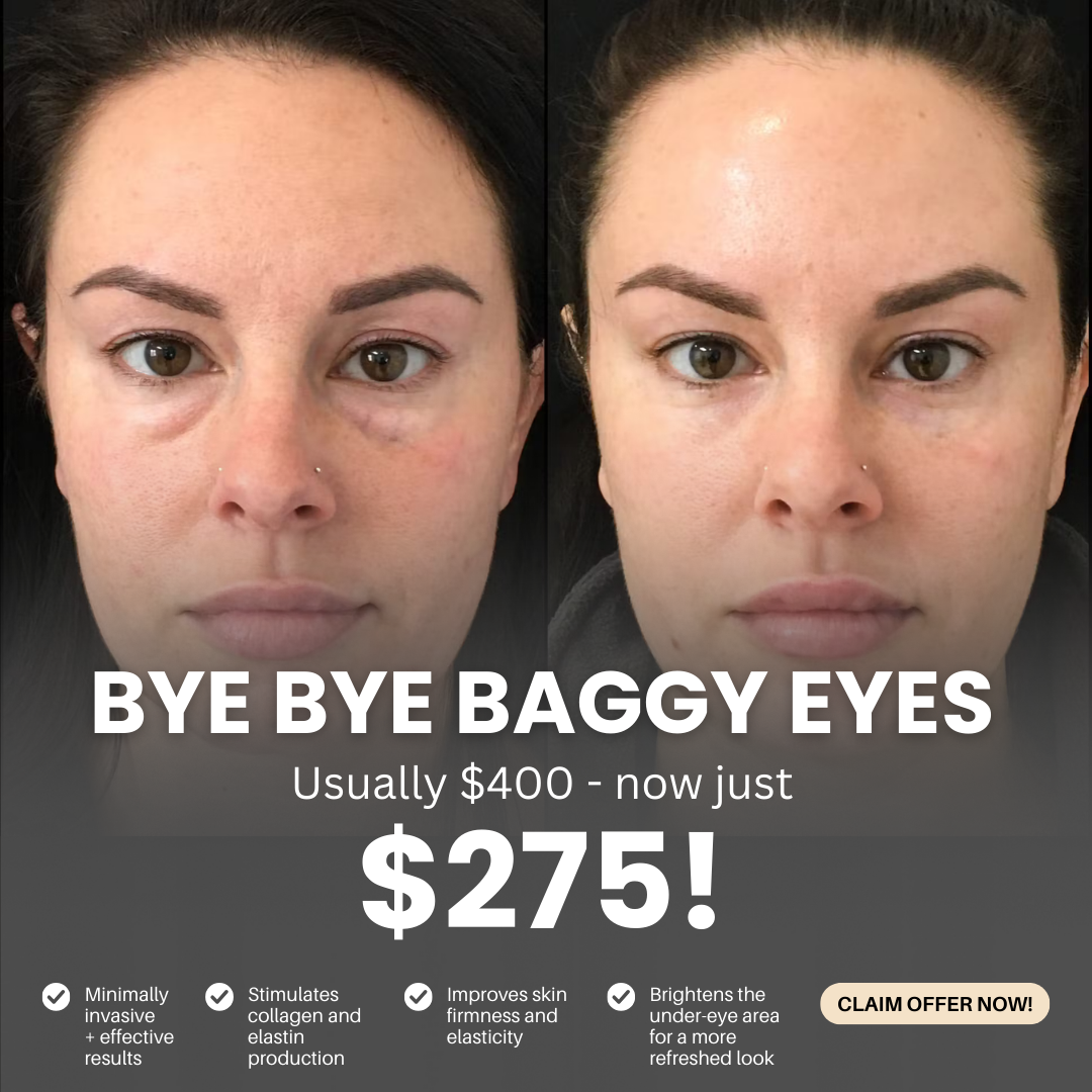 Elite Spa Massachusetts Facebook ad: Bye Bye Baggy Eyes for Only $275!