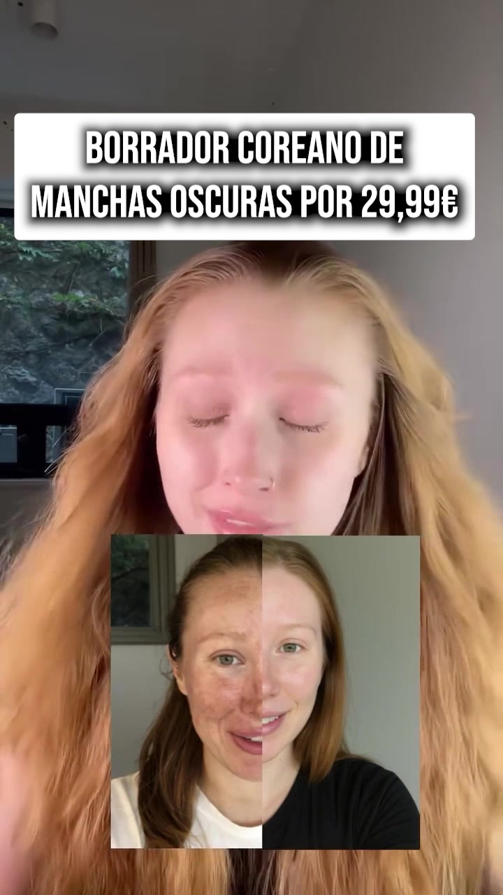 Infinite Love Facebook ad: Crema NIDA: Tu piel, hidratada y radiante desde…