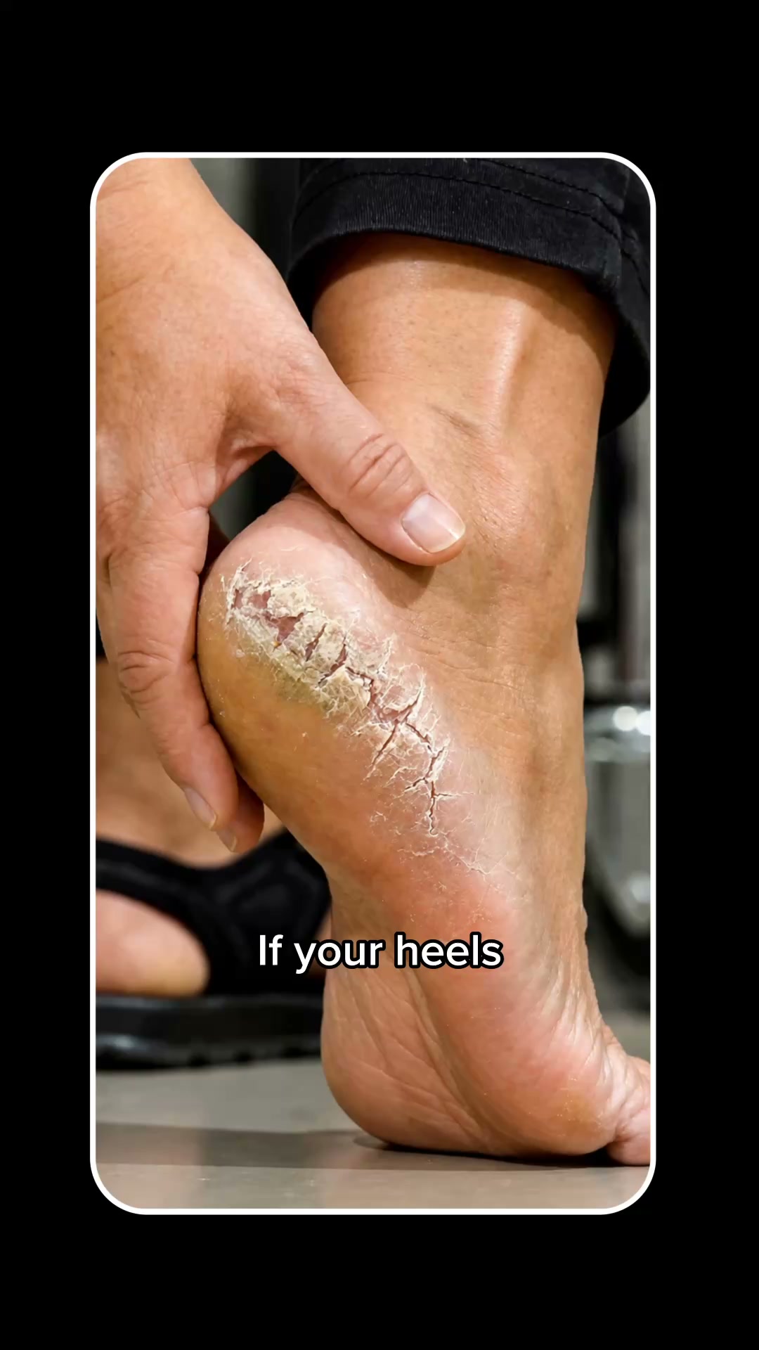 Nuvé Facebook ad: Smooth feet. In minutes. Guaranteed.