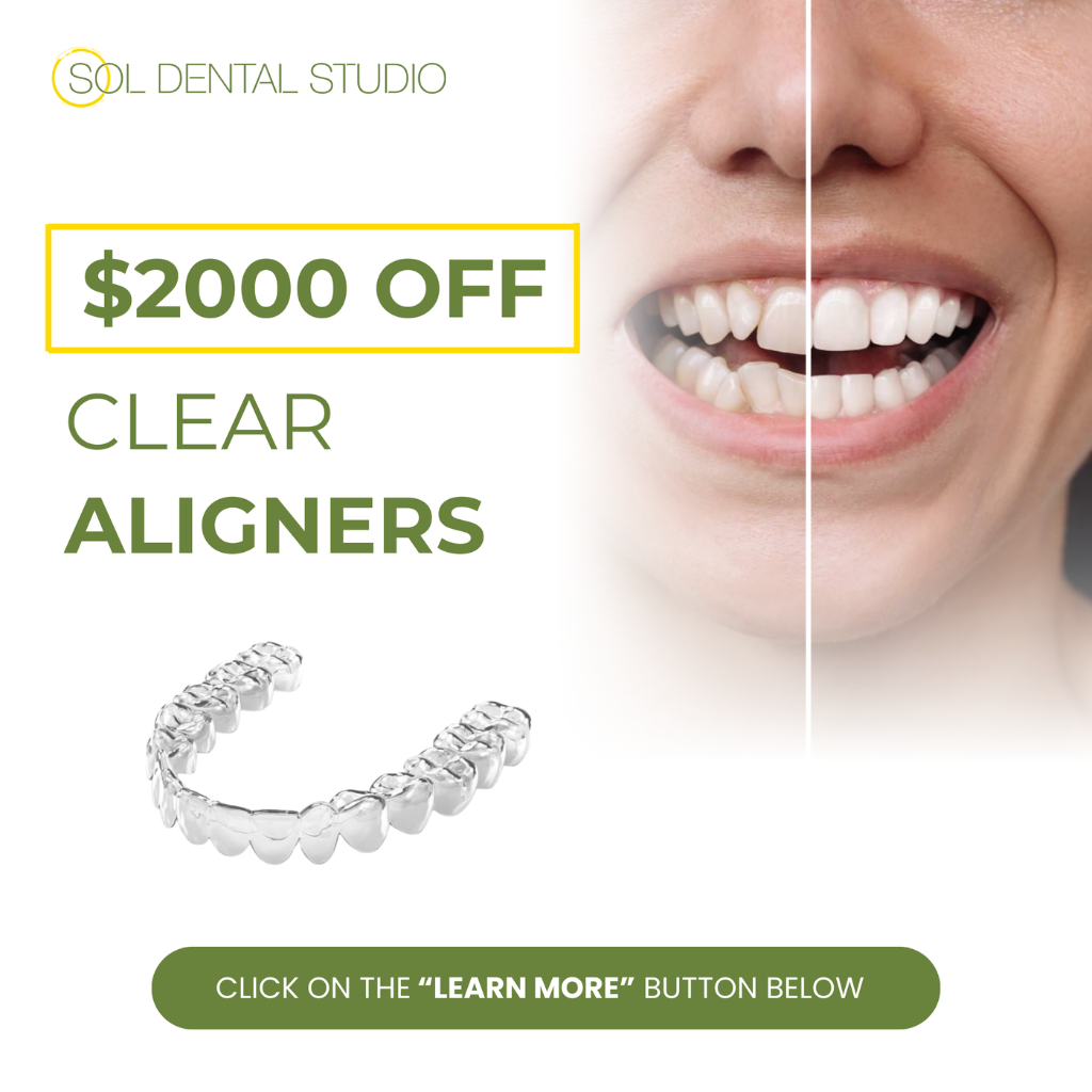 Sol Dental Studio Facebook ad: $2000 OFF Clear Aligner Special