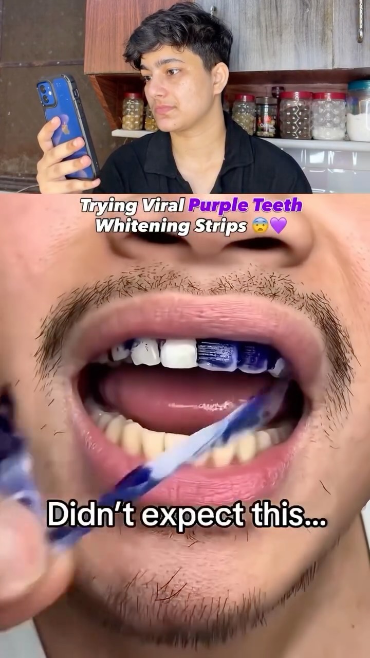Perfora Care Facebook ad: Teeth whitening strips