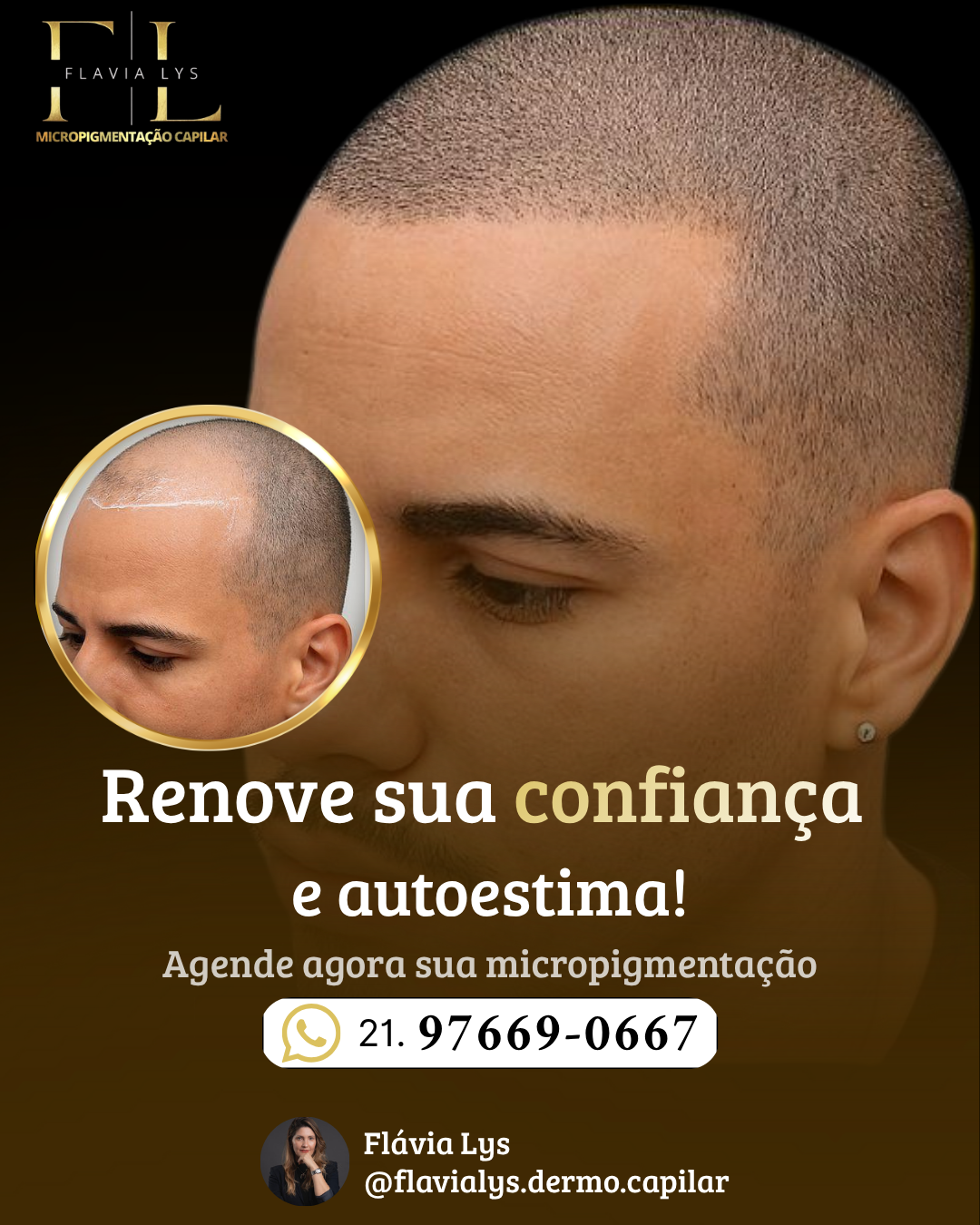 Flavia Lys Micropigmentaçao Facebook ad